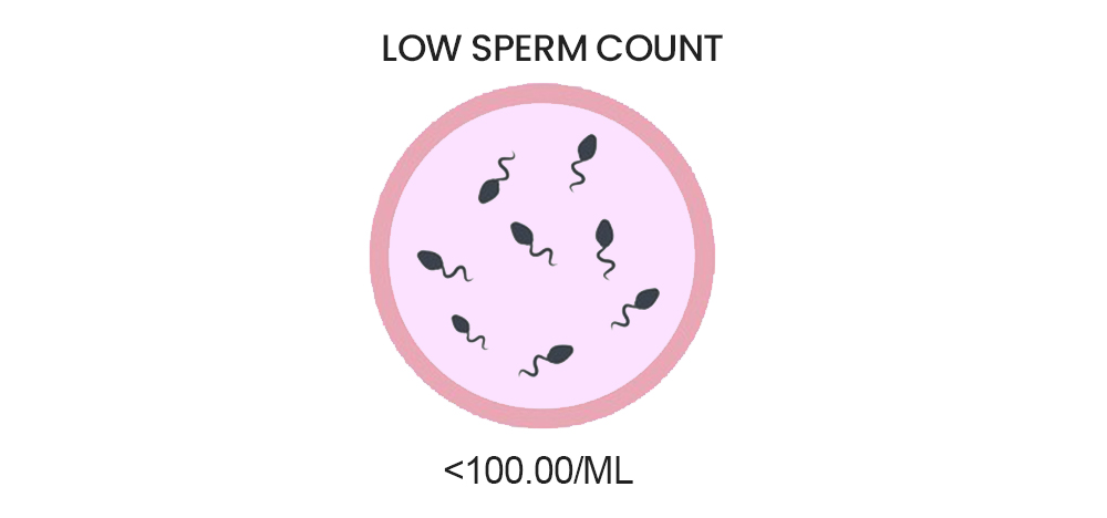 low sperm count shreshta fertility centre